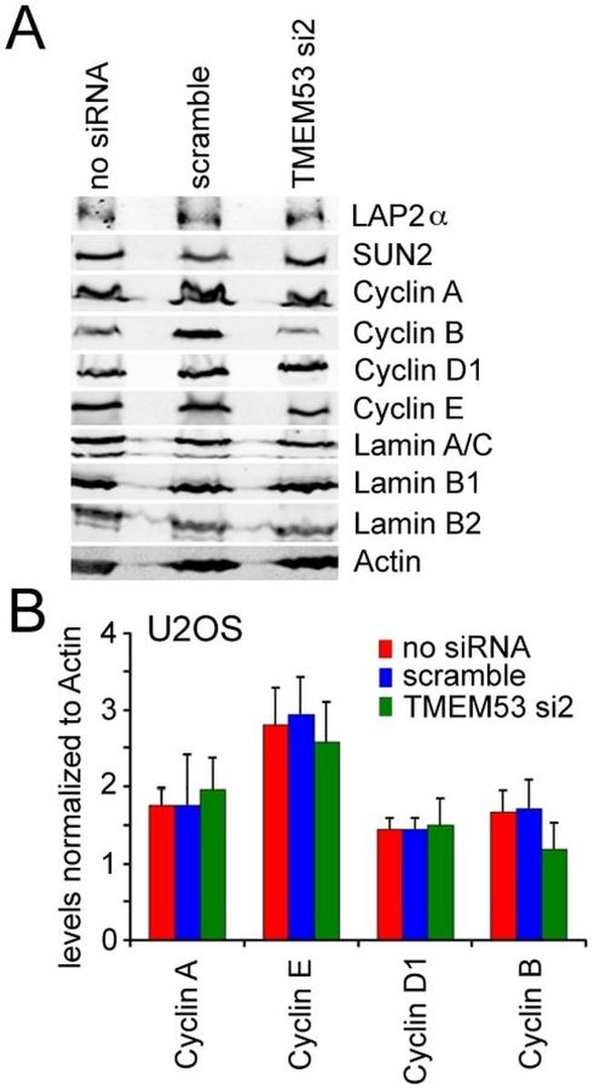 Cyclin E Antibody in Western Blot (WB)