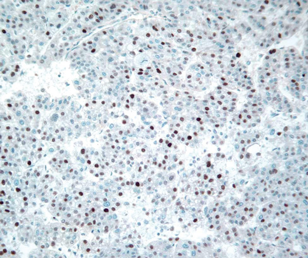 Cyclin E Antibody in Immunohistochemistry (IHC)