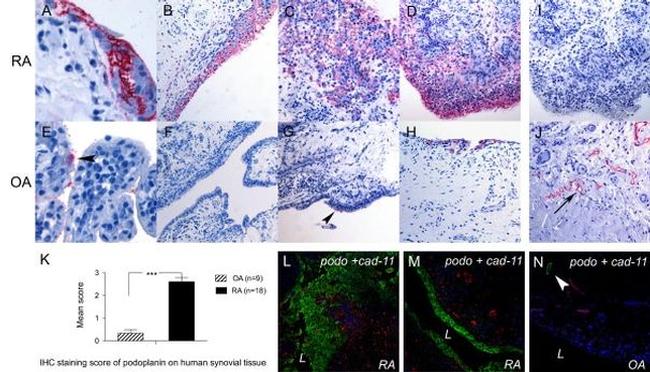 CDH11 Antibody in Immunohistochemistry (Paraffin) (IHC (P))