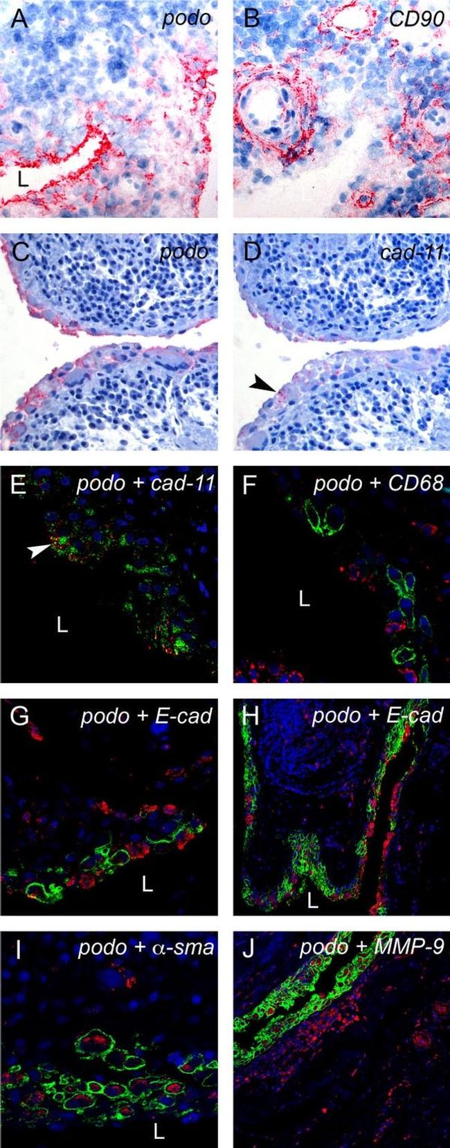 CDH11 Antibody in Immunohistochemistry (Paraffin) (IHC (P))