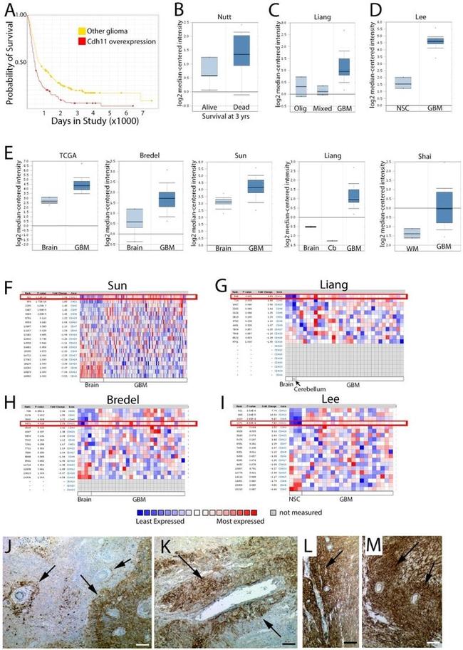 CDH11 Antibody in Immunohistochemistry (IHC)