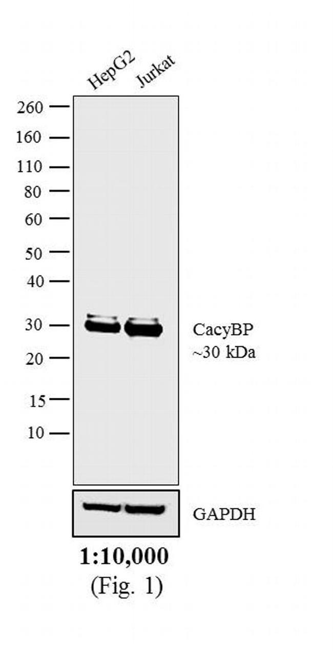 Rabbit IgG (H+L) Poly-HRP Secondary Antibody in Western Blot (WB)