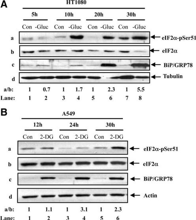 beta Tubulin Antibody in Western Blot (WB)