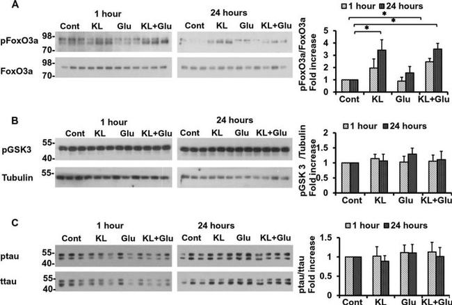 beta Tubulin Antibody in Western Blot (WB)