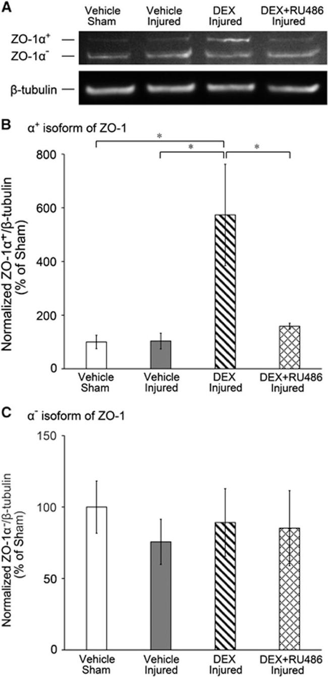 beta Tubulin Antibody in Western Blot (WB)