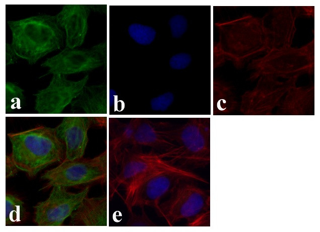 beta Tubulin Antibody in Immunocytochemistry (ICC/IF)