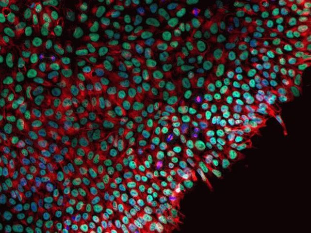 beta Tubulin Antibody in Immunocytochemistry (ICC/IF)