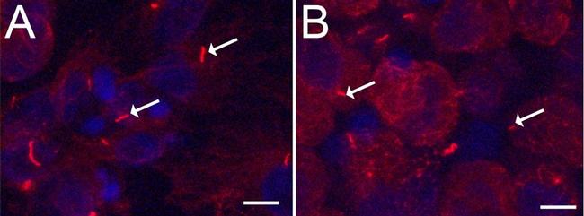 Acetyl-alpha Tubulin (Lys40) Antibody in Immunohistochemistry (IHC)