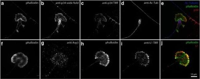 Acetyl-alpha Tubulin (Lys40) Antibody in Immunocytochemistry (ICC/IF)