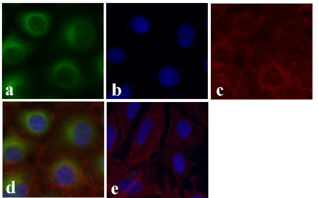 Acetyl-alpha Tubulin (Lys40) Antibody in Immunocytochemistry (ICC/IF)