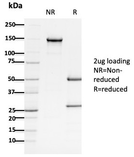 APC/Adenomatous Polyposis Coli/FAP (Tumor Suppressor) Antibody in SDS-PAGE (SDS-PAGE)