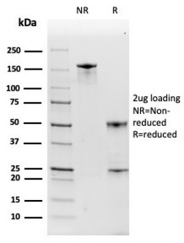 Haptoglobin (HP) Antibody in SDS-PAGE (SDS-PAGE)