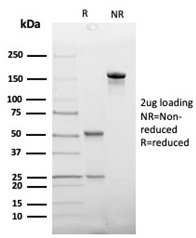 Haptoglobin (HP) Antibody in Immunoelectrophoresis (IE)