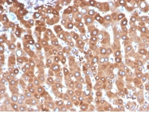 Haptoglobin (HP) Antibody in Immunohistochemistry (Paraffin) (IHC (P))