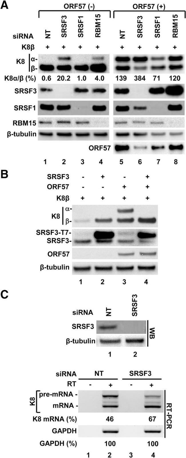 SRSF1 Antibody in Western Blot (WB)