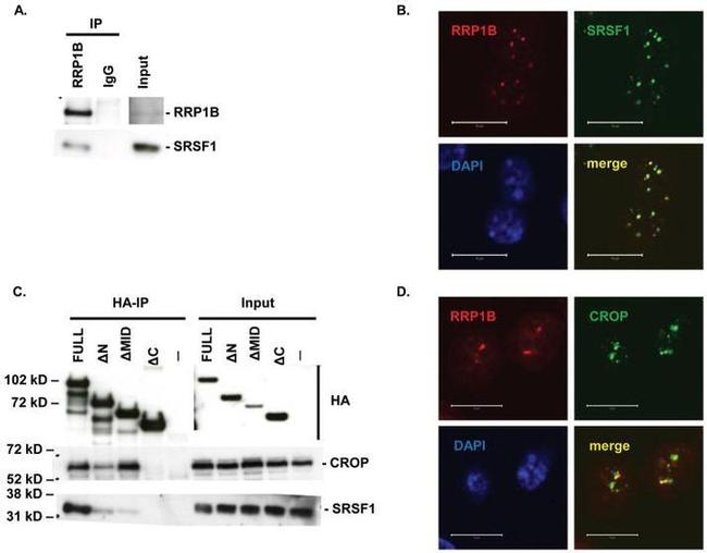 SRSF1 Antibody in Western Blot, Immunocytochemistry, Immunoprecipitation (WB, ICC/IF, IP)