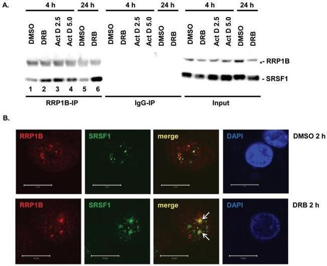 SRSF1 Antibody in Western Blot, Immunocytochemistry, Immunoprecipitation (WB, ICC/IF, IP)