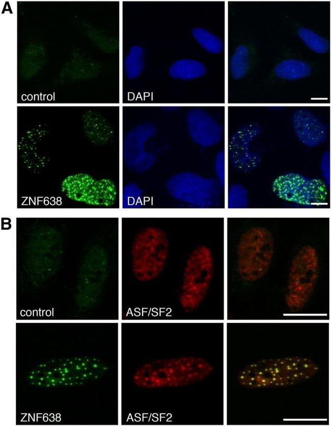 SRSF1 Antibody in Immunocytochemistry (ICC/IF)