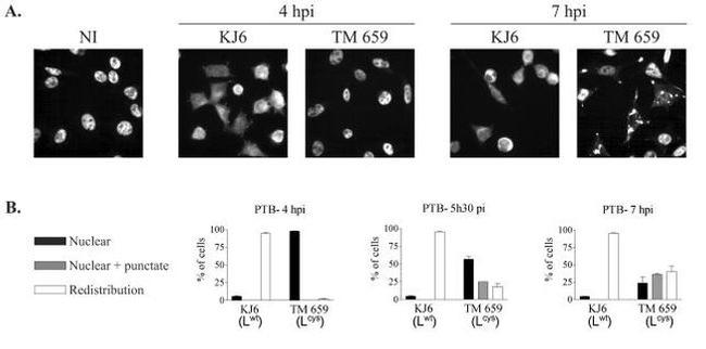 PTBP1 Antibody in Immunocytochemistry (ICC/IF)