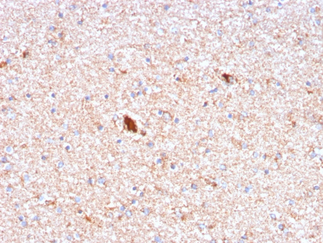 Serum Amyloid P/APCS Antibody in Immunohistochemistry (Paraffin) (IHC (P))