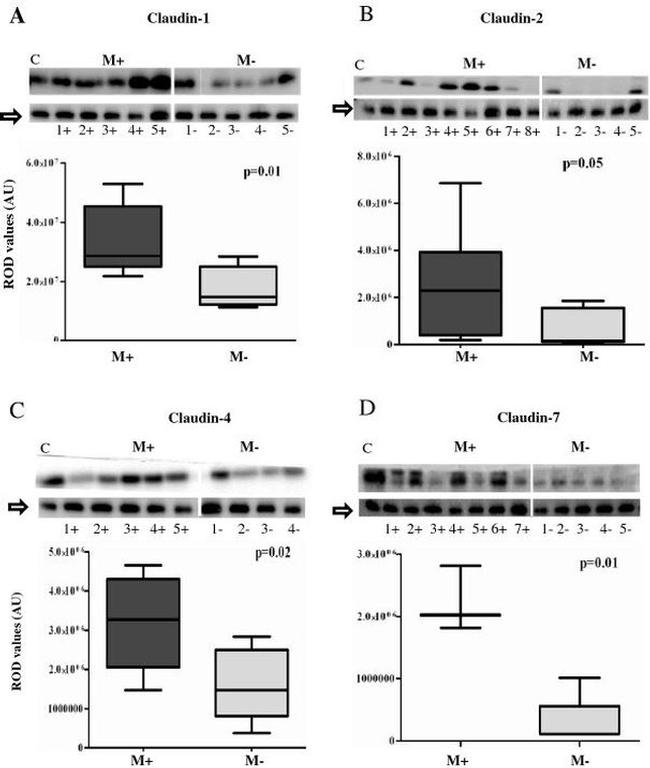 Claudin 7 Antibody in Western Blot (WB)