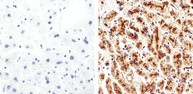 Claudin 2 Antibody in Immunohistochemistry (Paraffin) (IHC (P))