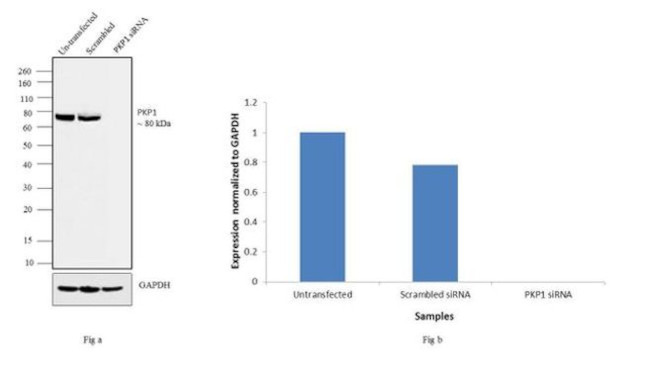 PKP1 Antibody