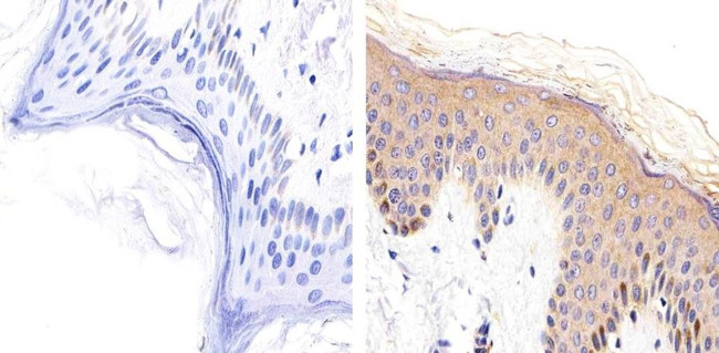 Desmoglein 1 Antibody in Immunohistochemistry (Paraffin) (IHC (P))