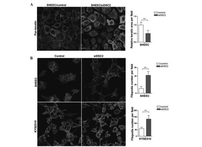 Desmocollin 2/3 Antibody in Immunocytochemistry (ICC/IF)