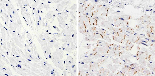 Desmocollin 2/3 Antibody in Immunohistochemistry (Paraffin) (IHC (P))