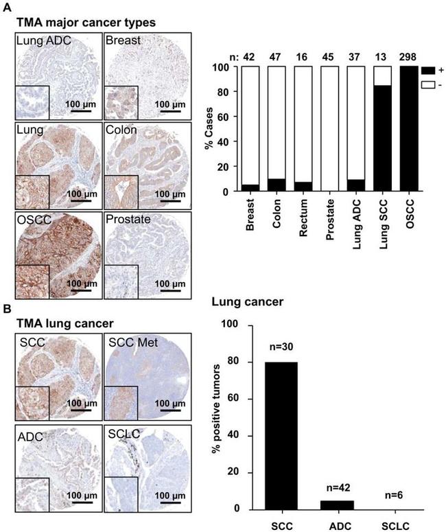 Desmoglein 3 Antibody in Immunohistochemistry (IHC)