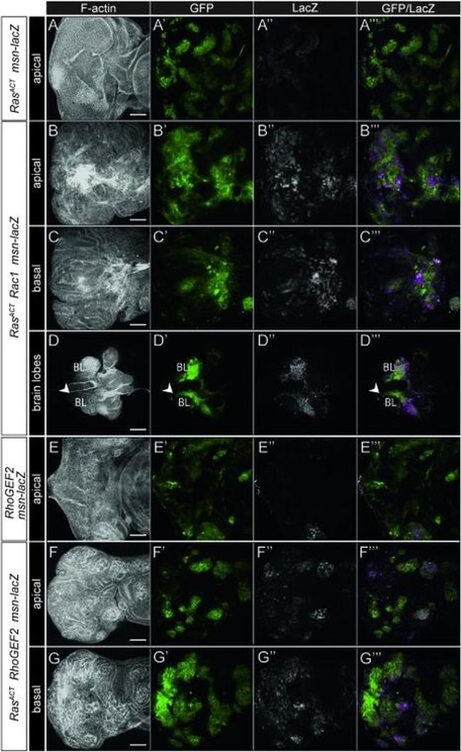 MEK7 Antibody in Immunohistochemistry (IHC)