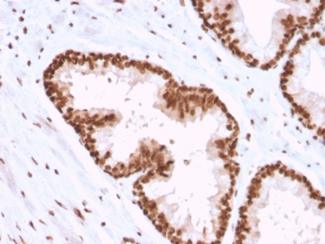 APEX Nuclease I Antibody in Immunohistochemistry (Paraffin) (IHC (P))