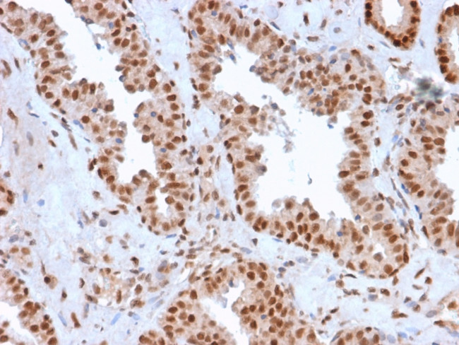 APEX Nuclease I Antibody in Immunohistochemistry (Paraffin) (IHC (P))