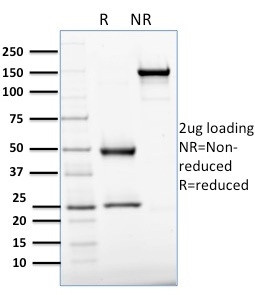 APEX Nuclease I Antibody in SDS-PAGE (SDS-PAGE)
