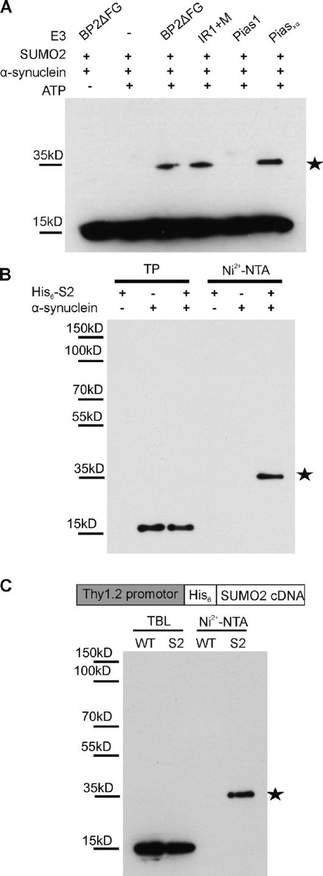 alpha Synuclein Antibody in Western Blot (WB)