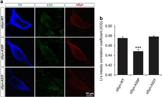 alpha Synuclein Antibody in Immunocytochemistry (ICC/IF)