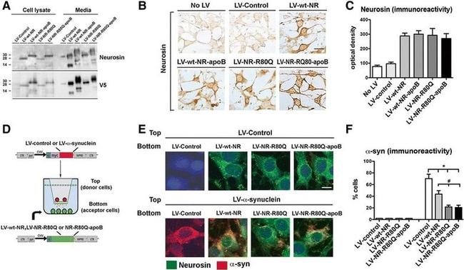 alpha Synuclein Antibody in Immunohistochemistry (IHC)