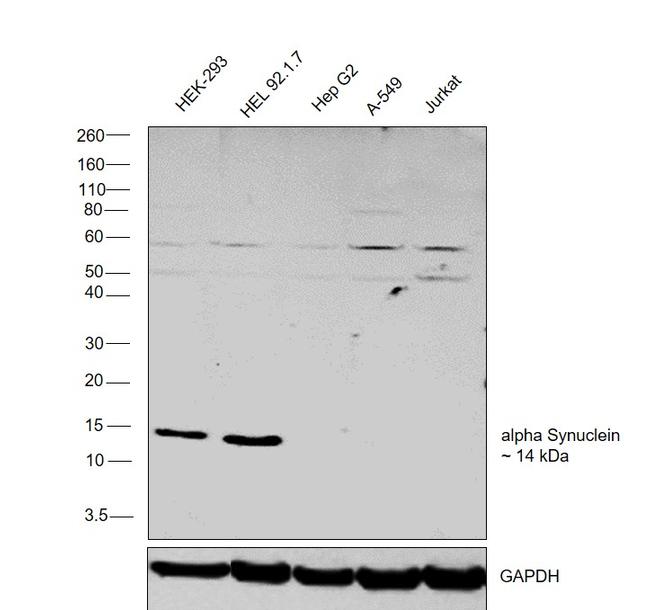 alpha Synuclein Antibody in Western Blot (WB)