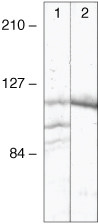 delta Catenin Antibody in Western Blot (WB)