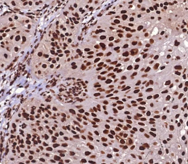 Heat shock 70 kDa protein 1B (HSPA1B) Antibody in Immunohistochemistry (Paraffin) (IHC (P))