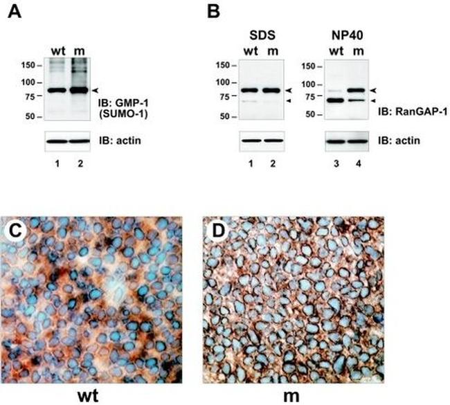 RANGAP1 Antibody in Immunohistochemistry (IHC)