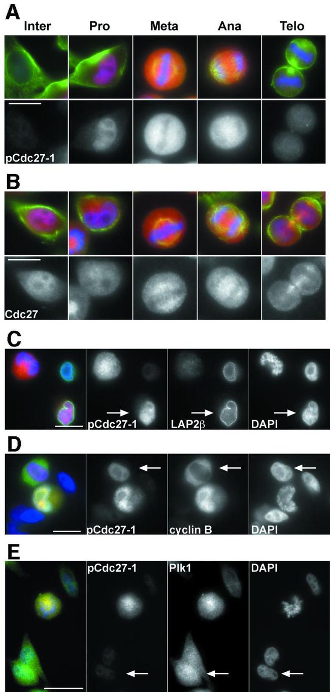 PLK1 Antibody in Immunocytochemistry (ICC/IF)