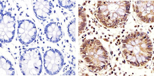 PLK1 Antibody in Immunohistochemistry (Paraffin) (IHC (P))