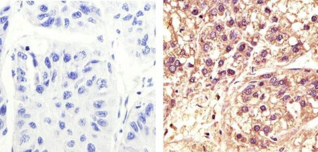 CDK1 Antibody in Immunohistochemistry (Paraffin) (IHC (P))