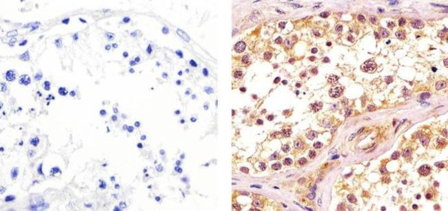 CDK1 Antibody in Immunohistochemistry (Paraffin) (IHC (P))