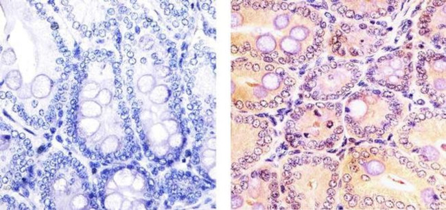 CDK1 Antibody in Immunohistochemistry (Paraffin) (IHC (P))