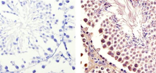 CDK1 Antibody in Immunohistochemistry (Paraffin) (IHC (P))