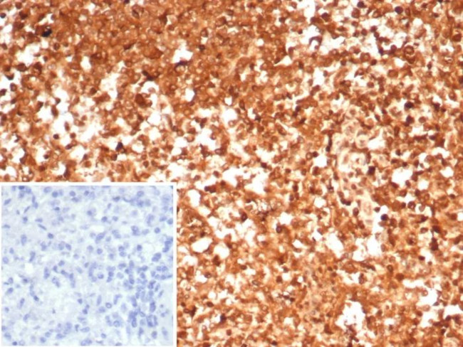 HSP90AA1 (Heat Shock Protein 90) Antibody in Immunohistochemistry (Paraffin) (IHC (P))