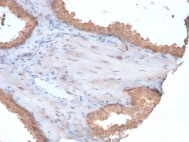 HSP90AA1 (Heat Shock Protein 90) Antibody in Immunohistochemistry (Paraffin) (IHC (P))